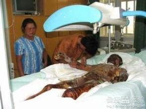 宫颈糜烂吃瓜,揭秘“吃瓜群众”关心的健康之谜