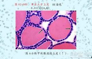 宫颈糜烂吃瓜,揭秘“吃瓜群众”关心的健康之谜